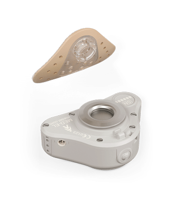 سیستم شنوایی ADHEAR